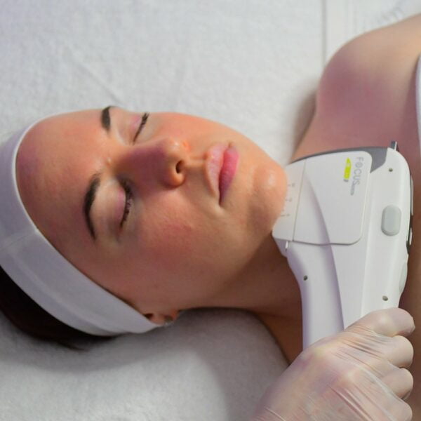 HIFU,Treatment,Skin Treatment,Wrinkle Reduction,Beauty Salon,Beaubelle,Collagen